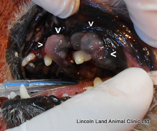 																					The arrow points to a place that was not easily visible during a routine exam.  A tumor was growing there and removed by a 